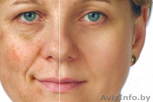 Акция на Пилинг  от салона красоты «У Юлии» - Изображение #1, Объявление #993654