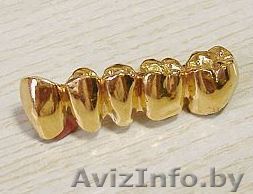 КУПЛЮ золото КОРОНКИ монеты Сам приеду к вам +375(29)6О2-14-11 - Изображение #1, Объявление #1623234