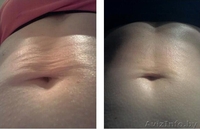 Аппарат Nu Skin BODY Galvanic Spa (Гальваник СПА) Технология из США в Минске - Изображение #8, Объявление #648383