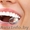 Протезирование, лечение зубов‎. Профессионально. п.Колодищи - Изображение #5, Объявление #1528601