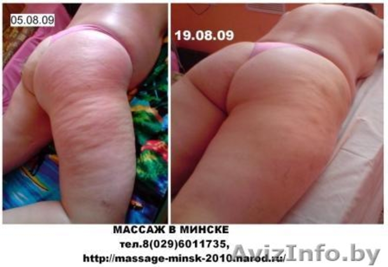 МАССАЖ В МИНСКЕ:т.8(029)6011735, http://massage-minsk-2010.narod.ru - Изображение #3, Объявление #59845