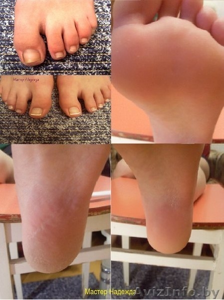 Педикюр. Депиляция. Наращивание ногтей гелем. Маникюр. - Изображение #2, Объявление #875654