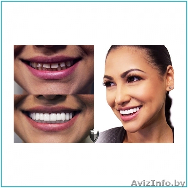 Съемные виниры  SnapON smile (нижние) - Изображение #5, Объявление #1639921